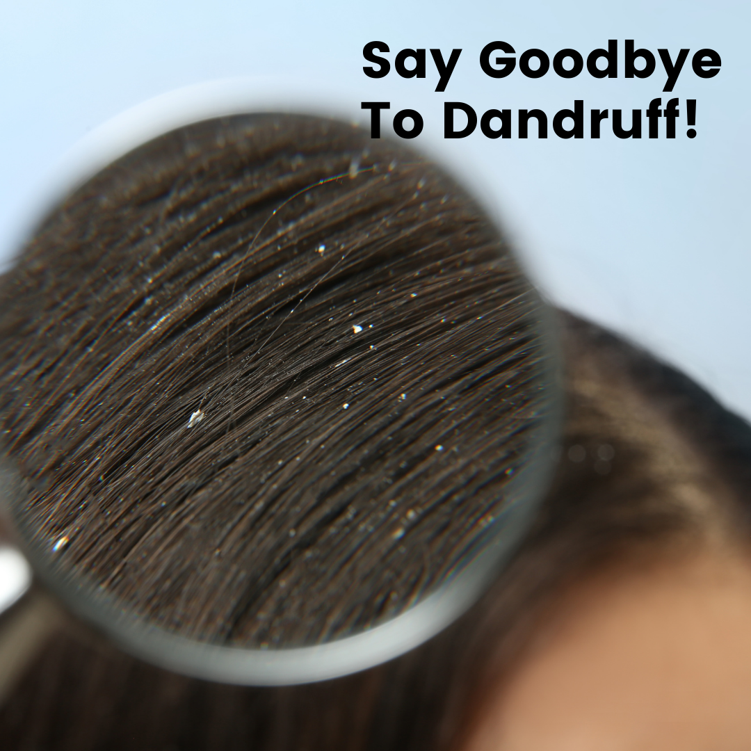 Dandruff Oil