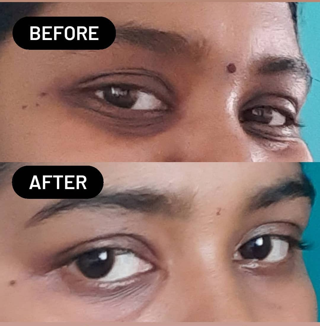 Under Eye Gel