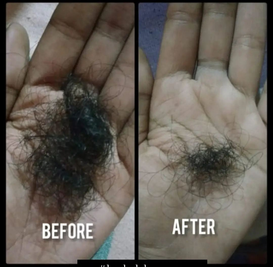 Magical Hair Growth Oil