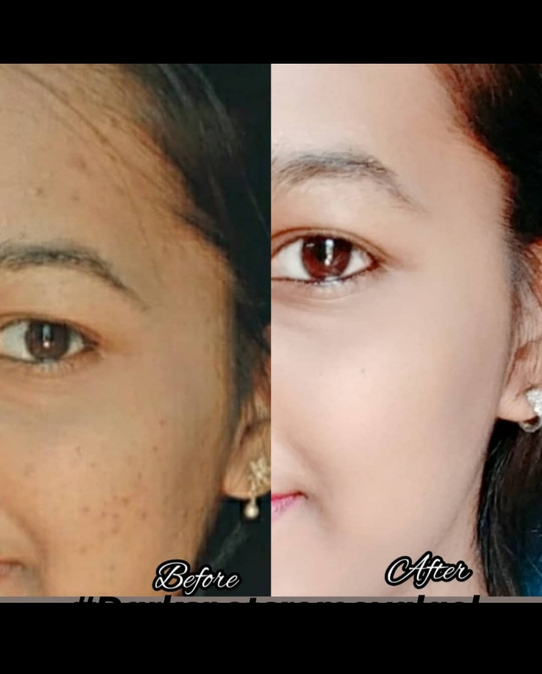 Skin Shining kunkumathi Serum
