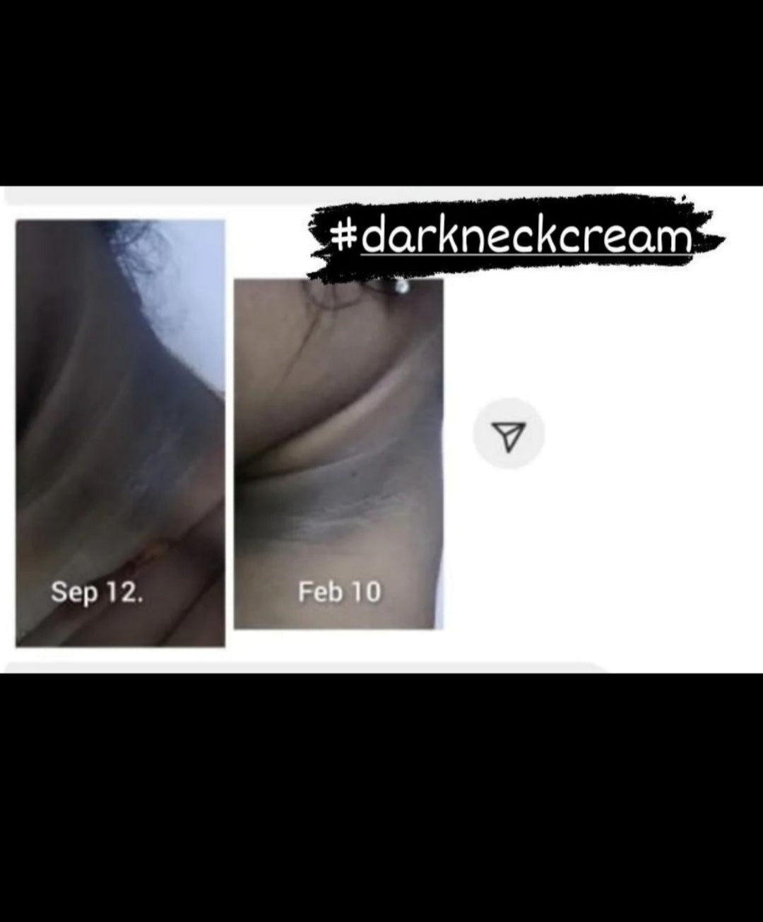 Dark Neck Cream