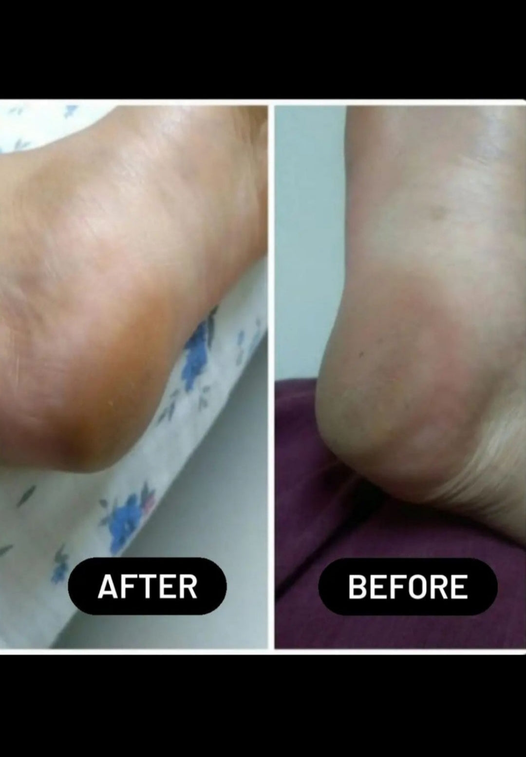 Foot Creamy Herbal Lotion