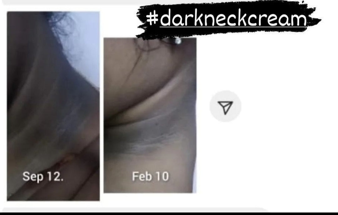 Dark Neck Kit