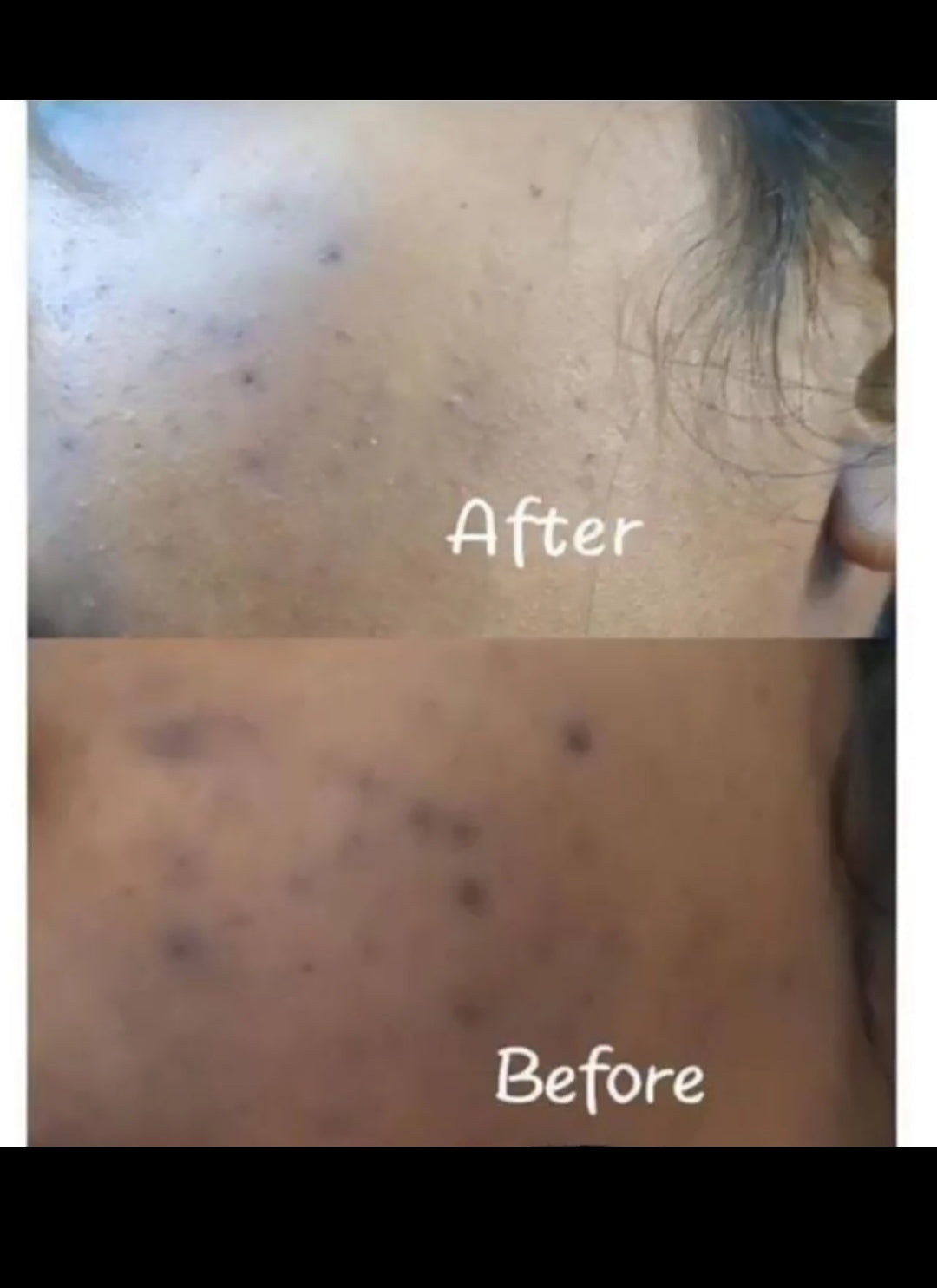 Spots Remover Kit
